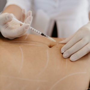 Mesoterapia Corporal