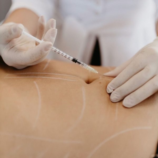 Mesoterapia Corporal